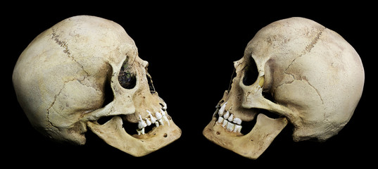 Human skull laid on black background