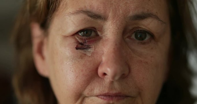 Close-up of sad older woman with bruised and scarred face looking to camera
