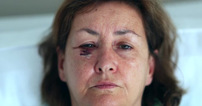 Older woman with bruise scar face opening eyes looking to camera