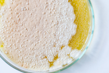 Colony characteristic of Actinomyces, Bacteria, yeast and Mold on selective media from soil samples for study in laboratory microbiology.
