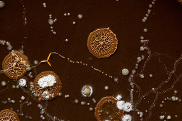 Colony characteristic of Actinomyces, Bacteria, yeast and Mold on selective media from soil samples for study in laboratory microbiology.