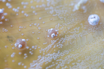 Colony characteristic of Actinomyces, Bacteria, yeast and Mold on selective media from soil samples for study in laboratory microbiology.