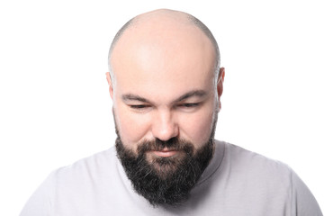 Man with hair loss problem on white background