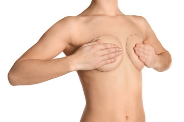 Obraz premium Young woman with marks on breast for cosmetic surgery operation against white background