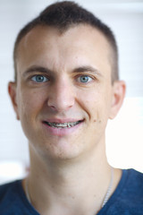 Fototapeta premium Portrait of man with crooked white ugly teeth close-up. Dental braces on the teeth in dentistry. Orthodontics and bite correction. Terrible smile. Problem, care and toothache