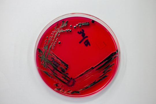 Bacteria in culture media