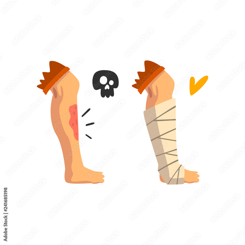 Canvas Prints Wounded leg, physical injury, bandaged leg, first aid and treatment vector Illustration on a white background