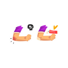 Elbow injury, first aid and treatment vector Illustration isolated on a white background