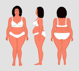 Vector illustration. Front, back, side view of naked European woman in full growth in underwear. Advertising of cosmetic plastic procedures, stomach shunting, bypass, diet, medical publications