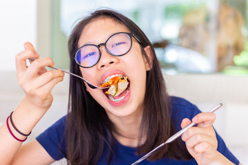 Young female teenager with dental braces eating and biting on her pizza
