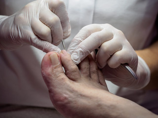 Female chiropodist working on a senior clients feet.