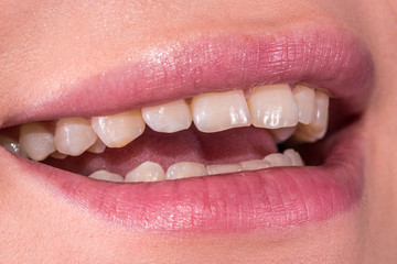 Woman smile with great natural teeth