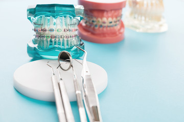 orthodontic model and dentist tool - demonstration teeth model of varities of orthodontic bracket or brace - obrazy, fototapety, plakaty
