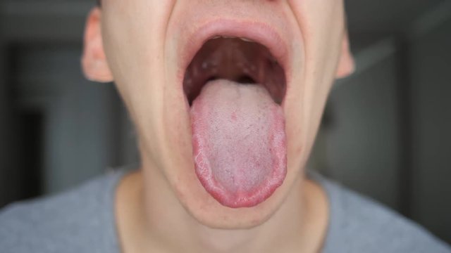 Close-up of man shows his mouth, tongue and teeth
