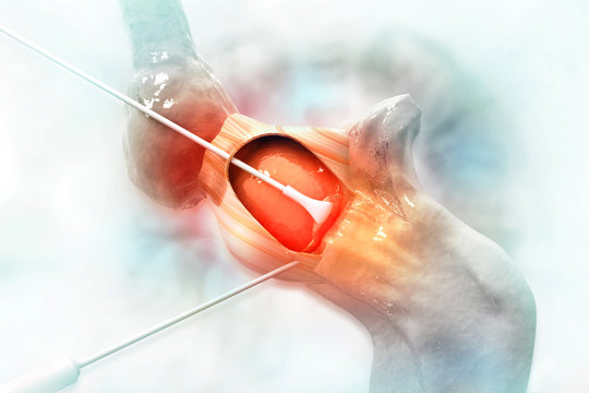 Human knee joint surgery