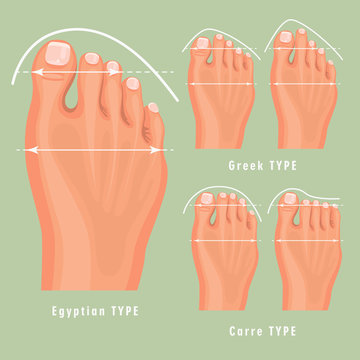 Foot Type Vector Detailed Concept With Germanic, Celtic, Greek And Roman Form