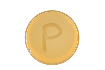 bacteria escherichia coli culture on plate in shape letter p