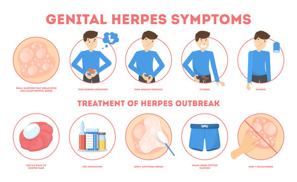 Genital herpes symptoms. Infectious dermatology disease illustration