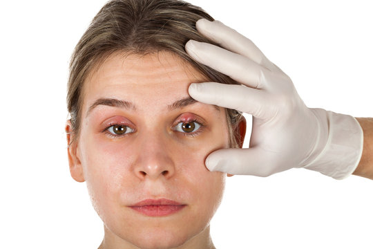 Ophthalmic infection