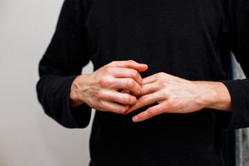 Man scratch oneself, dry flaky skin on hand with psoriasis vulgaris, eczema and other skin...