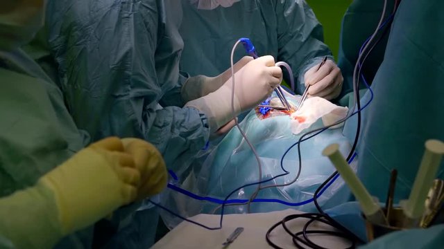 Close-up of a team of surgeons performing surgical operation on a patients head, difficult operation.