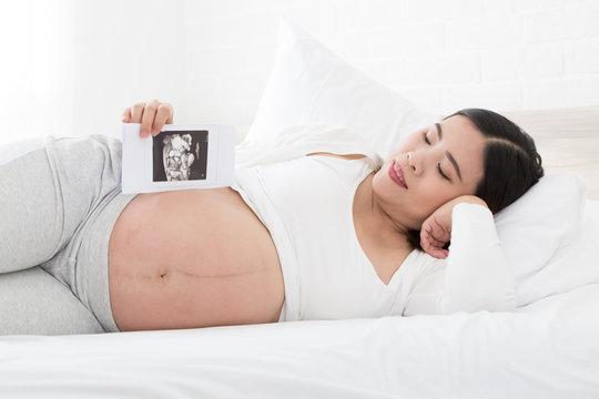 Pregnant women lie on their left side on bed and hold four-dimensional ultrasound images on hand, Techniques and abdominal applications, Prenatal diagnosis concept, Asian pregnancy woman model