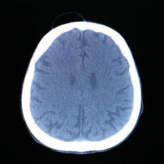 X-ray scanner of head background.