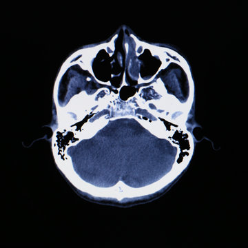 X-ray scanner of head background.