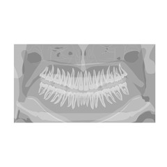 panoramic dental  X-ray. human jaw.isolated on white.Stock vector illustration