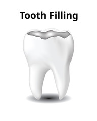 Tooth Filling, isolated on white background, Realistic design illustration Vector.