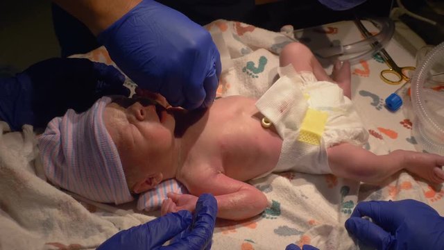 Newborn Premature Baby Heart Lungs Check by Doctors