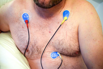 Touch halter on the human body. Diseases of the cardiovascular system. Diagnosis, prevention and...