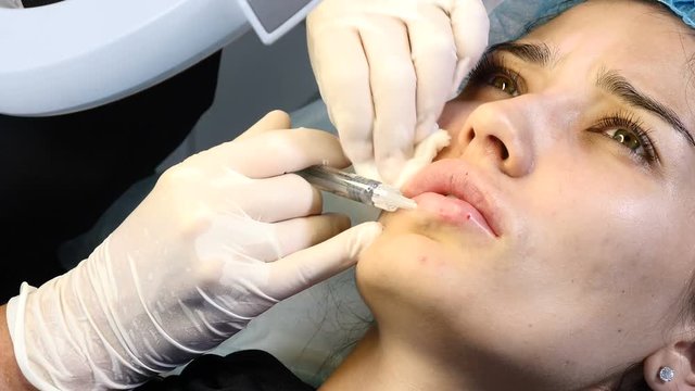 Beauty treatment. Modern beauty clinic. Young woman gets lip augmentation procedure. Filler injection in healthcare clinic. Close up. 4k