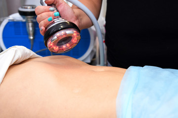 Rf skin tightening. Vacuum massage. Hardware cosmetology. Body care. Non surgical body sculpting....