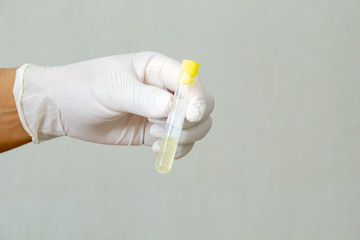 Hand of a doctor holding a bottle of Viral Transport Media (VTM) in wall laboratory room.