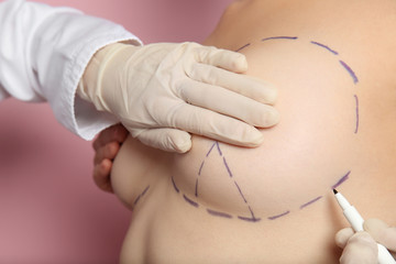 Doctor drawing marks on female breast before cosmetic surgery operation against color background
