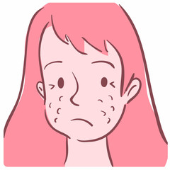 Illustration of a girl face with acne