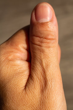 Woman's scar skin on thumb of hand, Close up & Macro shot, Asian Body skin part, Healthcare concept, Abstract background