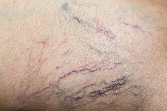 Woman's dry skin on calf of the leg, Close up & Macro shot, Asian Body skin part, Healthcare concept, Abstract background