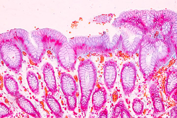 Tissue of Stomach under the microscopic, Physiology of the stomach for education in laboratory.