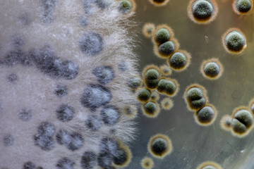 Colony characteristic of Actinomyces, Bacteria, yeast and Mold on selective media from soil samples for study in laboratory microbiology.