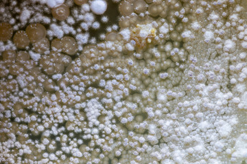 Colony characteristic of Actinomyces, Bacteria, yeast and Mold on selective media from soil samples for study in laboratory microbiology.