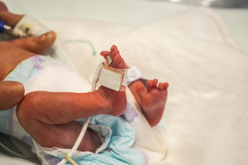 New born baby at the hospital in neonatal care 