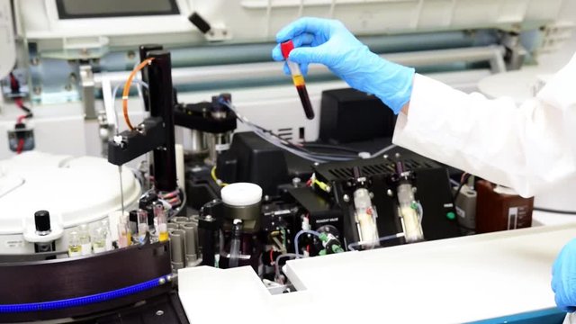 an employee of the laboratory examines the tube with blood on the background of the apparatus for automated blood analysis 