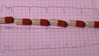 Medical therapy on electrocardiogram