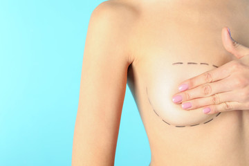 Young woman with marks on breast for cosmetic surgery operation against color background, closeup