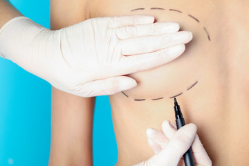 Doctor drawing marks on patient's breast for cosmetic surgery operation against color background,...