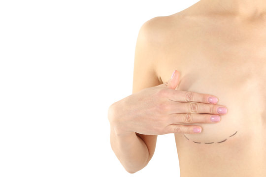 Young woman with marks on breast for cosmetic surgery operation against white background, closeup