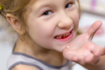 Cute little child has just lost the first milk tooth.
