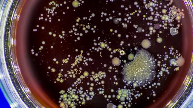 Pathogen bacteria from supermarket foods in a petri dish
